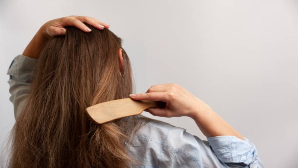 Ilustrasi folikel rambut dan siklus pertumbuhan rambut pada wanita.